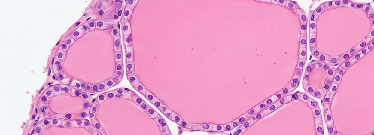 Nyhedsopslag billede (1)(1)